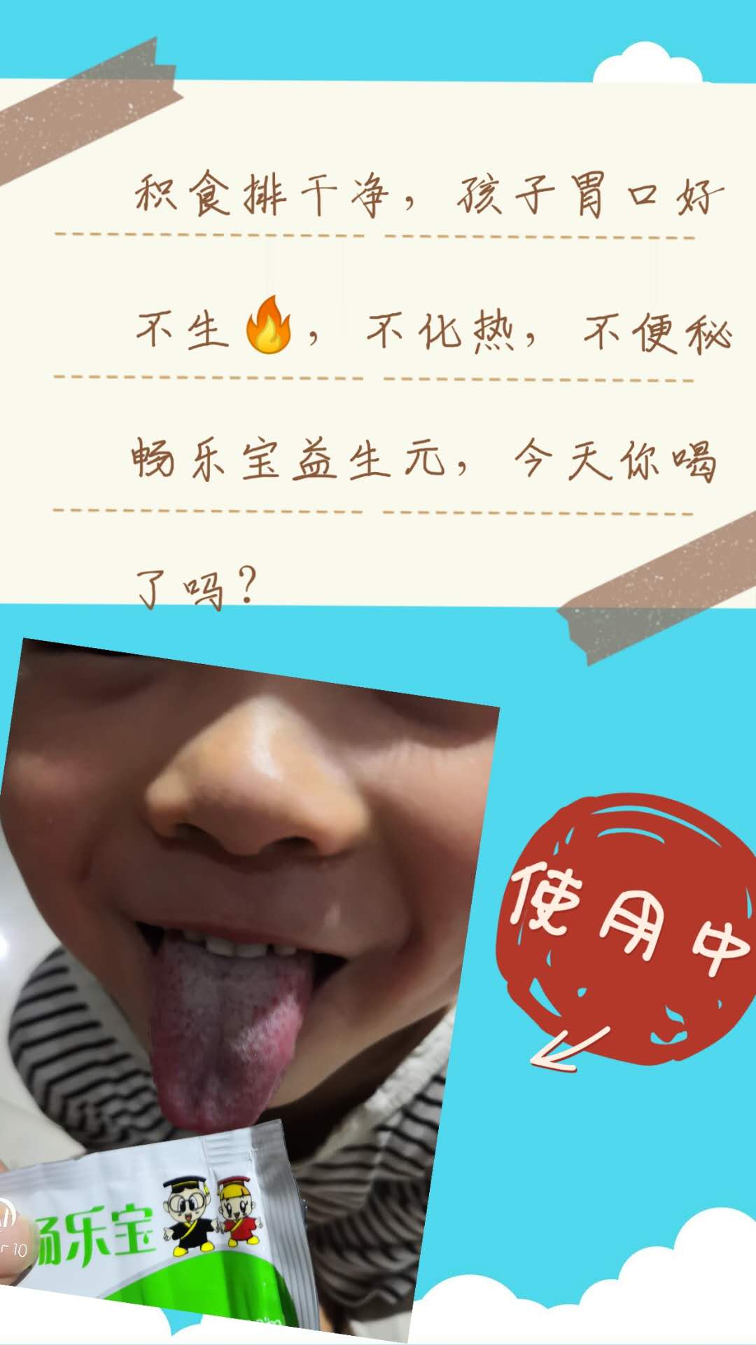 儿童便秘调理